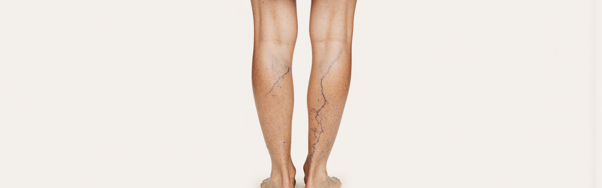 Comment se déroule un examen veineux ?