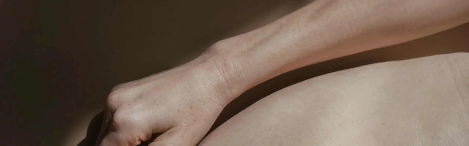 El caso particular del lipedema en las extremidades superiores